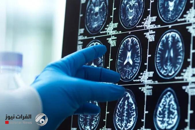 اكتشاف جديد يغير مفاهيم علمية قديمة حول مركز الانتباه